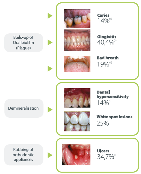 Teeth Whitening Service Flower Mound