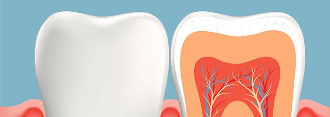 Dental implants