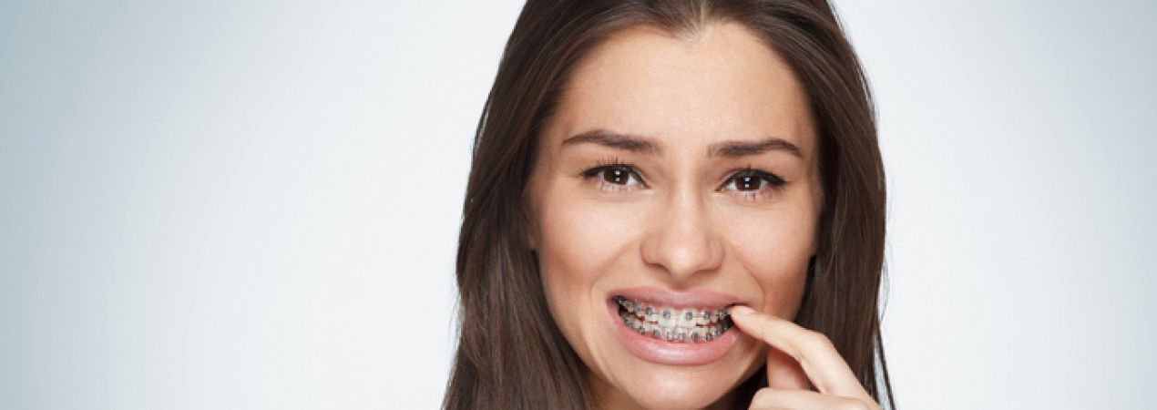 Daily oral hygiene in orthodontics