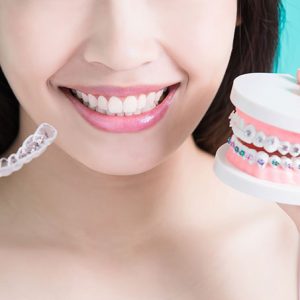 Orthodontics for adults