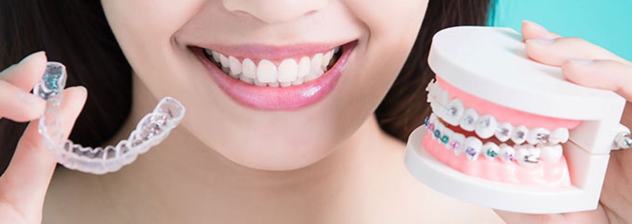 Orthodontics for adults
