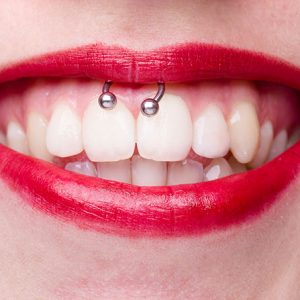 Piercings and oral health problems
