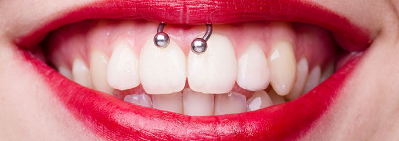 Piercings and oral health problems