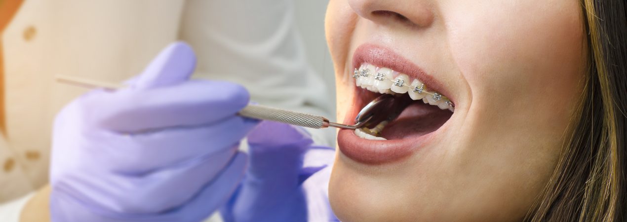 Fixed Brace Care