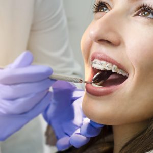Fixed Brace Care